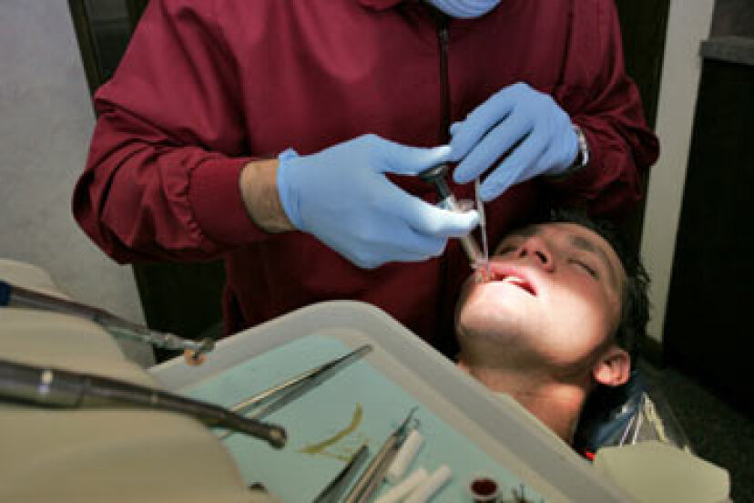 Cómo cuidar un diente con absceso