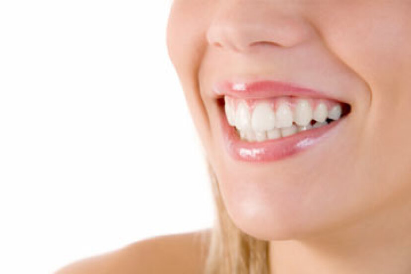 Schaden Bleaching-Strips Ihren Zähnen?